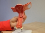 anatomisch model baarmoederhals