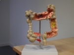 anatomisch model dikkedarm